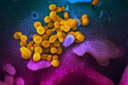 Virus SARS-CoV-2 có khả năng bị phát tán khi nói