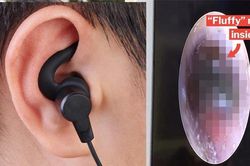 Bé trai mọc nấm trong tai vì 'nghiện' đeo tai nghe