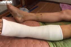 Trưởng Ban Nội chính Thái Bình gây tai nạn rồi bỏ trốn: Lời kể người thoát chết