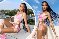 Siêu mẫu Winnie Harlow diện bikini thả dáng gợi cảm trên mái nhà