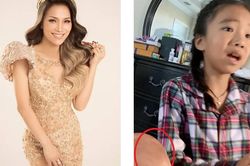 Hồng Ngọc lộ vết bỏng lớn ở chân, xúc động vì thấy con gái nhỏ lo lắng