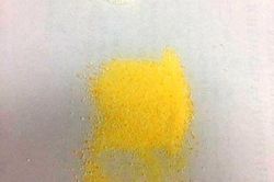 Trẻ co giật toàn thân sau khi uống thuốc bột màu vàng chữa tiêu chảy