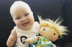 Búp bê cụt tay, bớt sắc tố kín người tiếp sức mạnh cho trẻ khuyết tật