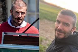 Vợ Beckham 'mừng thầm' vì chồng bị hói