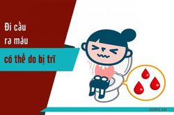 Giảm nhanh chảy máu trong bệnh trĩ