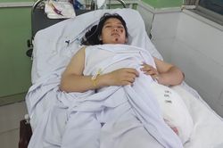 Nữ sinh 16 tuổi mất chân trái vì tai nạn trên đường đi học về