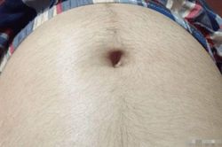 Phụ nữ mang thai mọc nhiều lông trên bụng có phải dấu hiệu sẽ sinh bé trai?