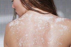 Bí quyết giúp bạn thoát khỏi 'cơn ác mộng' mang tên mụn cơ thể
