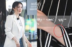 Dân mạng đau lòng khi thấy những vết sẹo như dao cứa trên cánh tay của Dương Mịch