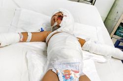 Hai bé trai bỏng nặng khi khu nhà trọ bị ném bom xăng