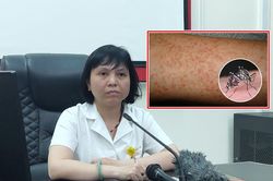 Sốt xuất huyết vào mùa, chuyên gia chỉ ra sai lầm khiến bệnh thêm nặng