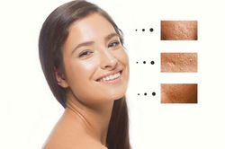6 cách se khít lỗ chân lông hiệu quả bằng tinh dầu tràm trà