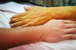 Màu da thay đổi hé lộ nhiều bệnh nguy hiểm