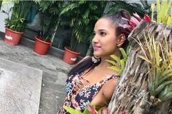 Cô gái bị điện giật mất 3 chi và nghị lực sống đầy mạnh mẽ