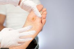 30 giây có thể mất 1 chân: Bạn cần nhớ điều này khi bị tiểu đường