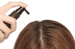 Nữ sinh viên trụi hết tóc chỉ vì dùng thuốc xịt rao bán qua mạng
