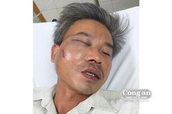Chủ quán 'Bố Già' bị tố đánh nhân viên cây xanh vỡ quai hàm