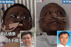 Trái chiều số phận 2 bác sỹ Vũ Hán cùng bị đổi màu da vì COVID-19
