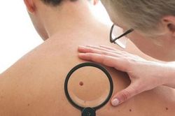 Israel phát hiện phương pháp khắc phục kháng thuốc ở khối u ác tính