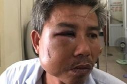 Khởi tố chủ quán cà phê đánh nhân viên cây xanh gãy xương hàm