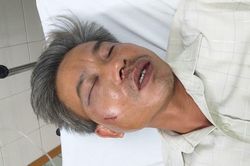 Khởi tố chủ quán cà phê đánh nhân viên công ty cây xanh bầm dập, vỡ quai hàm