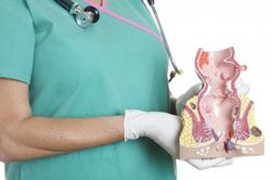 Xử trí bệnh nhồi máu trĩ