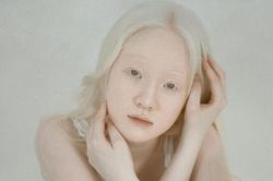 Nữ sinh bạch tạng đẹp như nàng thơ khi làm mẫu ảnh