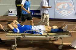 Hải Huy và những vụ gãy chân kinh hoàng trong làng bóng đá Việt
