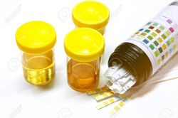 Màu nước tiểu nói lên điều gì về sức khỏe của bạn?