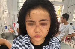 Hội Phụ nữ lên tiếng, cam kết bảo vệ cô gái bị hành hung gần 2 giờ