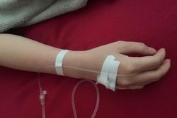 Cứu sống ca sốc phản vệ do truyền dịch tại nhà