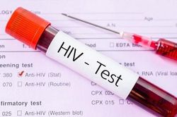 HIV có thể lan truyền từ não bộ
