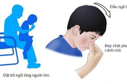 Cần làm gì khi trẻ bị chảy máu cam?
