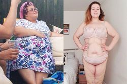 Bà mẹ đơn thân giảm 63 kg vì sợ chết ở tuổi 35