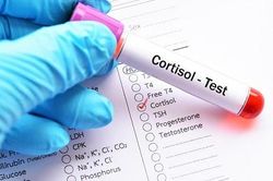 Cortisol cao làm tăng nguy cơ tử vong do COVID-19