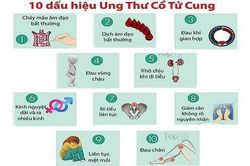 Nhận biết ung thư cổ tử cung giai đoạn sớm
