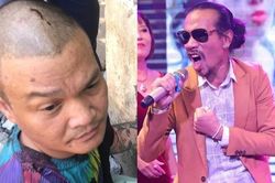 Bắt đối tượng cầm súng bắn trọng thương ca sĩ Hồ Phàm trong đêm