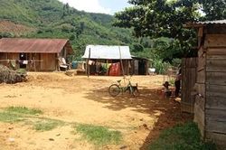 Một bệnh nhân Bạch hầu ở Đắk Nông có tiên lượng xấu