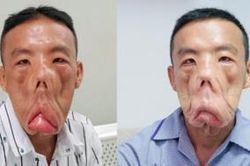 Anh Mến với gương mặt khác lạ, bác sĩ Tú Dung 'trần tình'