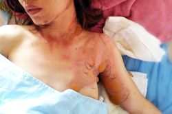 Một phụ nữ bị chặn xe, tạt xăng phóng hỏa gây bỏng nặng