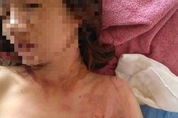 Đang đi đường, bị tạt xăng phóng hỏa