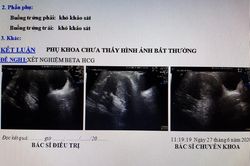 Đến viện chờ sinh, sản phụ mới biết mình không hề mang thai