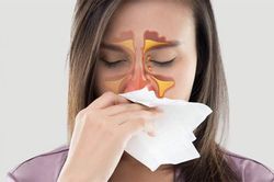 Những nguy cơ tiềm ẩn của bệnh viêm mũi, viêm xoang