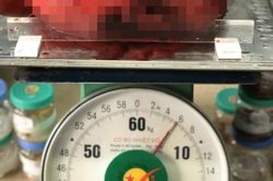 Nghi ngờ béo bụng, người phụ nữ có khối u khủng nặng 6kg