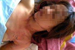 Bất ngờ thủ phạm tạt xăng cô gái ở Lâm Đồng