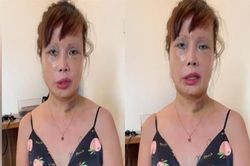Chưa dừng phẫu thuật thẩm mỹ, cô dâu 62 tuổi 'đại tu' vòng một