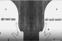 Phân biệt giữa sốt xuất huyết và sốt phát ban ở trẻ