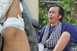 Hoài Linh 'tai nạn' chảy máu chân, đối tượng 'gây án' cực bất ngờ