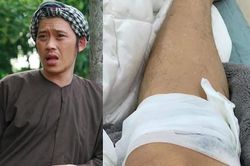 Hoài Linh chia sẻ ảnh bị tai nạn và 'tố' kẻ gây ra thương tích