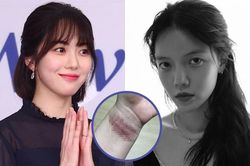 Nữ thần tượng Hàn nhiều lần tự tử vì bị bắt nạt suốt 10 năm